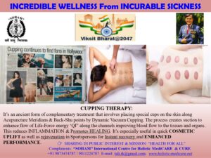 Cupping Therapy